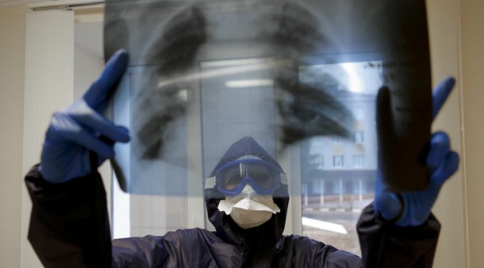 ВИДЕО: Хирург сподели снимки и покажа како изгледаат белите дробови на здрави пациенти, пушачи и на овие кои го прележале коронавирусот